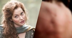 Glumica iz Igre prijestolja pokazala strašne ožiljke od bičevanja: "Stvarni su"