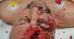 Političar AfD-a pretučen na ulici drvenim palicama, zadobio teške ozljede glave