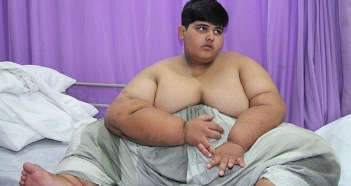 Najdeblji dječak na svijetu ima tek deset godina i gotovo 200 kilograma