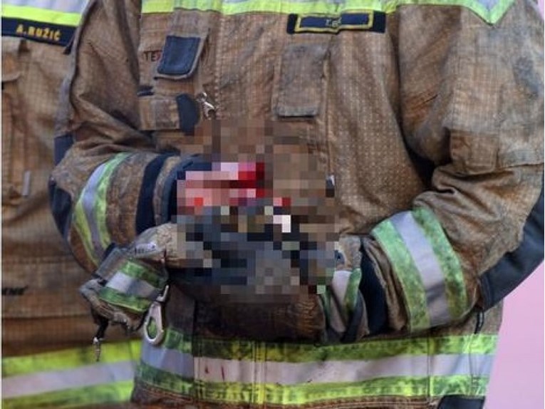 Uznemirujuće fotografije: Teška ozljeda vatrogasca na derbiju Hajduka i Dinama