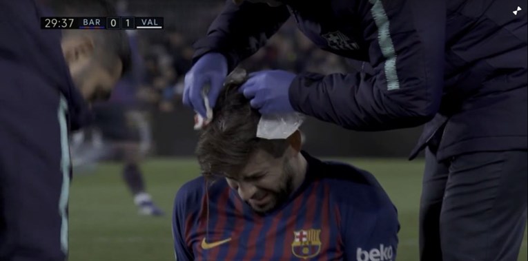 VIDEO Pique za rođendan ostao raskrvavljene glave protiv Valencije