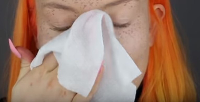 VIDEO Htjela slatke pjegice na licu, dočekala je katastrofa koju ne može oprati