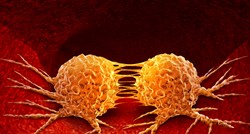Znanstvenici zaustavili širenje raka pretvorivši ga u masne stanice