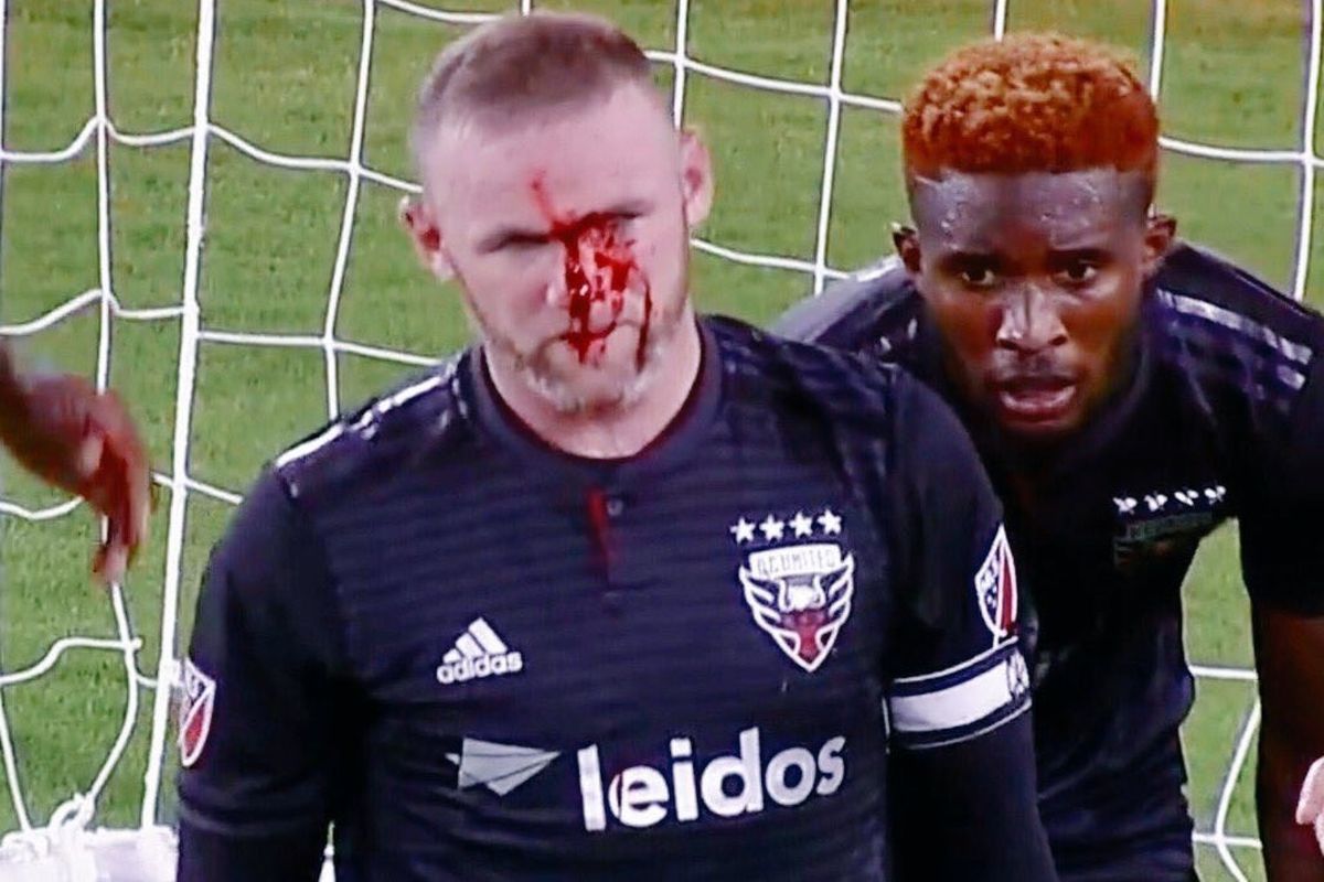 Rooney zabio prvijenac u Americi pa mu stradalo lice
