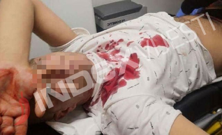 Javio se izbodeni mladić iz Zaprešića: "Živ sam, na nečiju žalost"