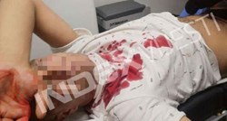 Javio se izbodeni mladić iz Zaprešića: "Živ sam, na nečiju žalost"