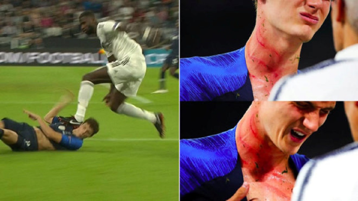 UZNEMIRUJUĆA SCENA Ovakav trag ostavio je Rudiger gaženjem Pavardova vrata