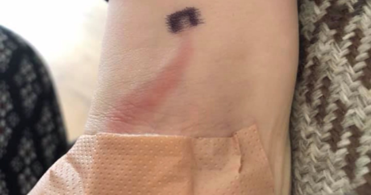 Mama spasila sinu život nakon što je uočila neobičan znak sepse