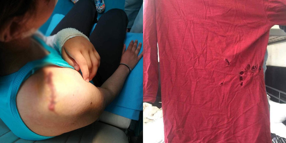 Ispovijest migranata u koje je pucala policija: Tražili smo hitnu, a policija nas je tukla