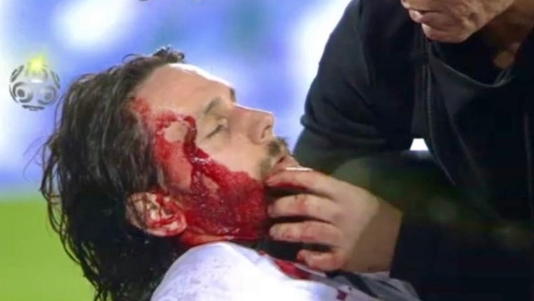 Bivši srpski reprezentativac teško ozlijeđen nakon što je dobio koljenom u glavu