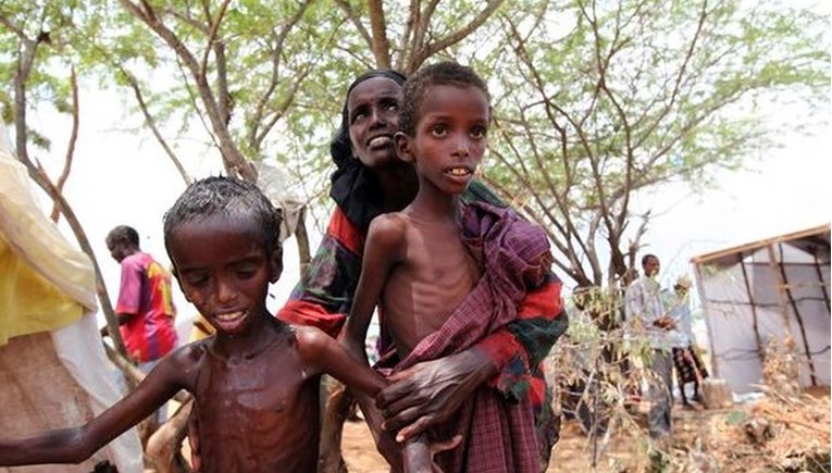 U Jemenu 300.000 djece umire od gladi i bolesti
