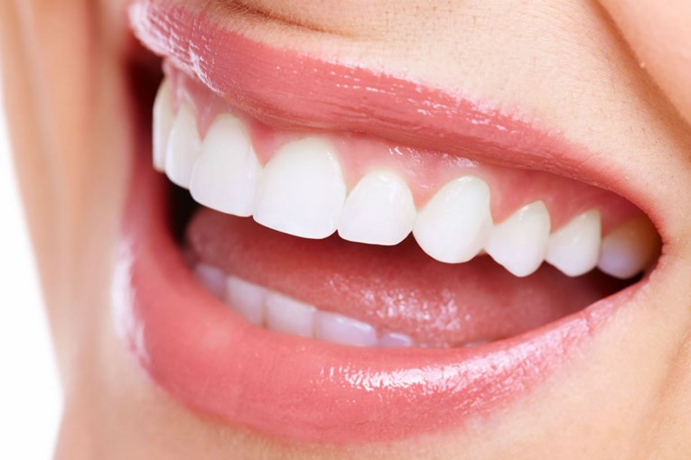 Na ovaj brz i jednostavan način možete otkriti imate li zdrave zube