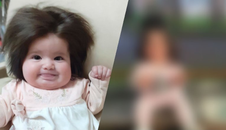 Beba rođena s hrpom kose zaradila nadimak Zlatokosa, pogledajte je danas
