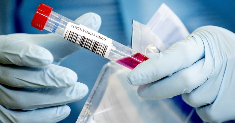 Prvenstvo im počelo, a oni prijavili 25 zaraženih koronavirusom