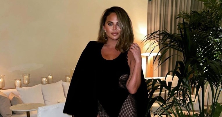 Chrissy Teigen otkrila da se podvrgnula zahvatu uklanjanja masti iz obraza