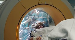 Umjetna inteligencija mogla bi dijagnosticirati demenciju nakon jednog pregleda