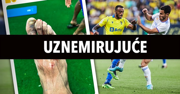 Hazard slomio dvije kosti u stopalu suparnika. On pokazao kako mu noga izgleda