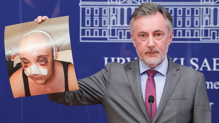 Škoro o slučaju mladića pretučenog zbog pjesme Mata: Država financira cajkaški radio
