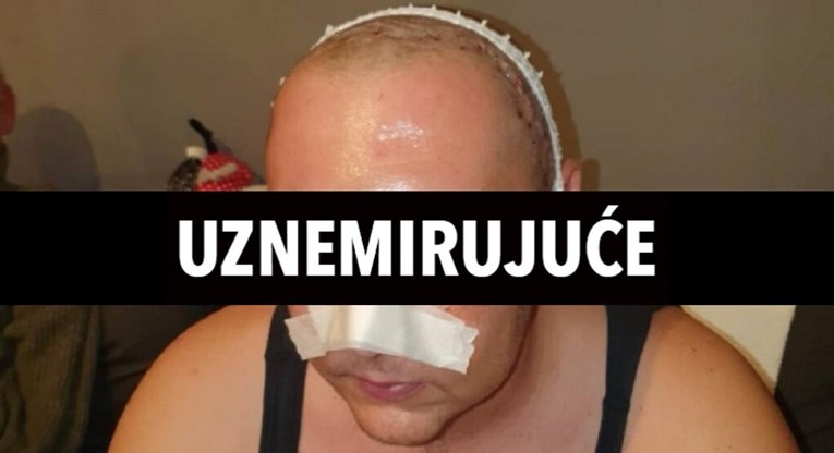 Vinkovčanin (28): Na slavlju sam tražio Škorinu pjesmu, Srbi su mi razbili lubanju