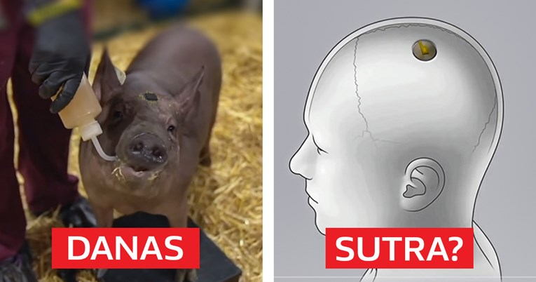 Elon Musk je prvo čipirao svinju, a sada to nudi i ljudima. Biste li pristali?
