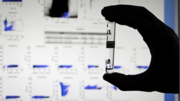 Studija: Teški oblik korone mogao bi izazvati autoimune napade