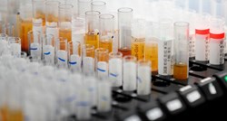 Znanstvenici iz Edinburgha tvrde da su razvili brz i precizan serološki test