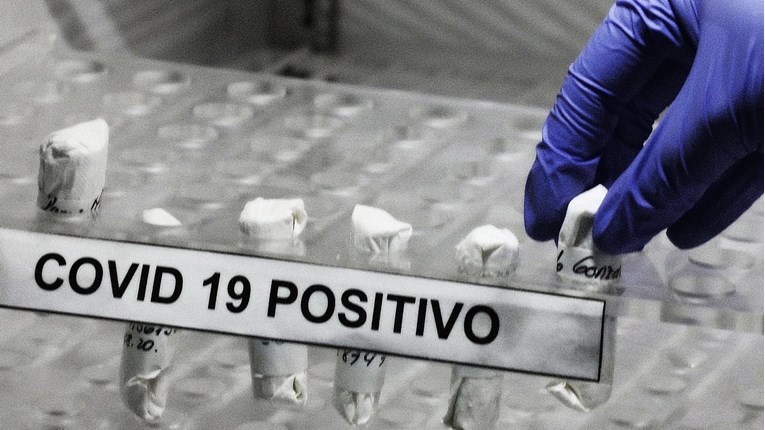 Znanstvenici istražili koliko dugo traje imunitet nakon oboljenja od korone