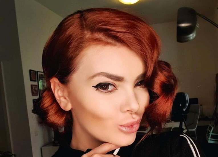 Ella Dvornik pokazala lice nakon estetskog tretmana: Bez brige, splasnut će to