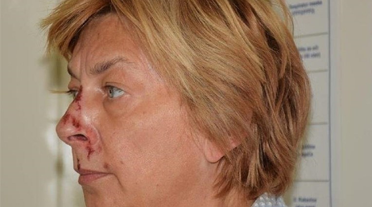 CNN piše o ženi pronađenoj na Krku: "Još se ne zna tko je ona, javilo se par ljudi"