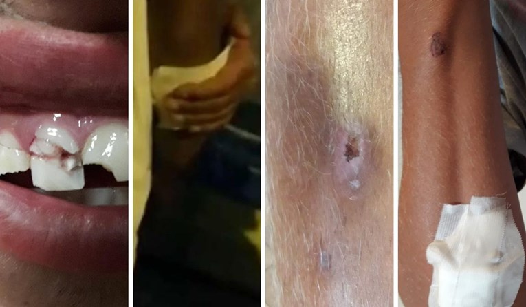 Pretučeni Slavonci za Index otkrili: "Nas su uhitili, a napadače pustili"