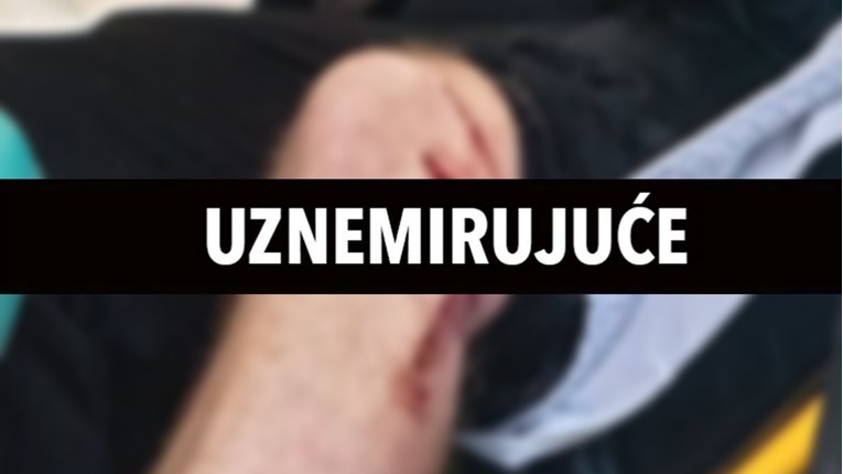 Policijski pas ugrizao navijača u Nizozemskoj, navijači ozlijedili policijskog konja