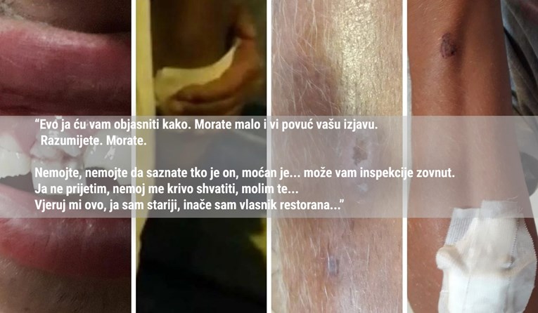 VIDEO Rođak napadača na sezonce prijeti: "Moćni su, povuci prijavu ili..."