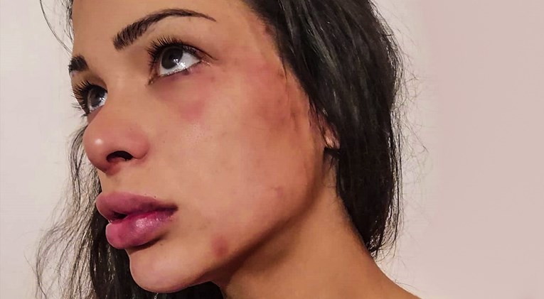 Kći Medvedova pomoćnika: Otac me pretukao i gurao mi lice u mokraću