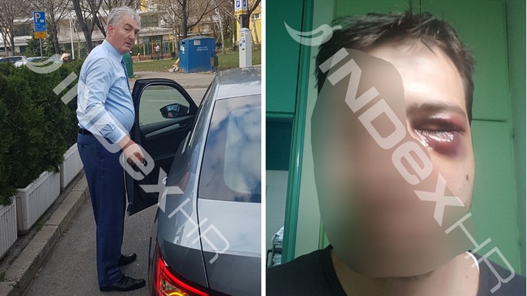 Moćni HDZ-ovac u Zagrebu brutalno nokautirao mladića i prijetio mu specijalcima