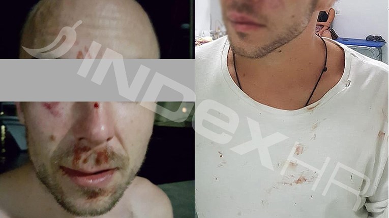 Mladi Austrijanci pretučeni na Paklenim otocima: "Zaštitari su me cipelarili"