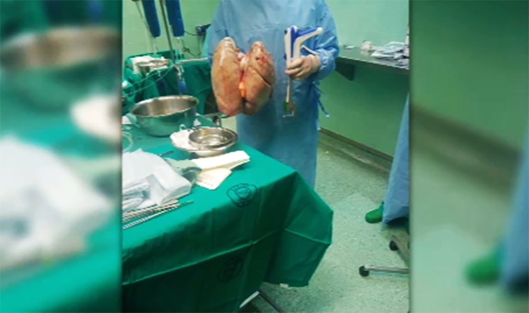 Veliki uspjeh: U Hrvatskoj prvi put transplantirana oba plućna krila