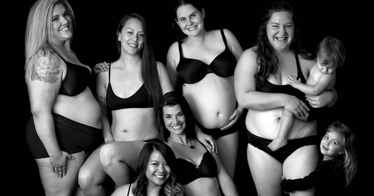 Mama snažnim fotografijama pokazuje tijelo nakon carskog reza i šalje važnu poruku