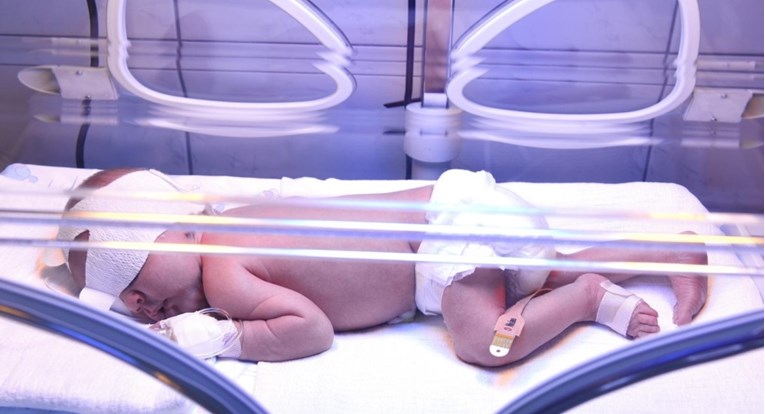 Na Rebru izveli carski rez na trudnici s covidom, bila je na respiratoru