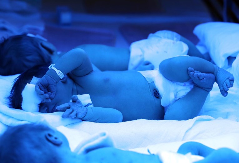 Ministarstvo: Bolnice lijek za bebe rođene prije roka mogu kupiti na domaćem tržištu