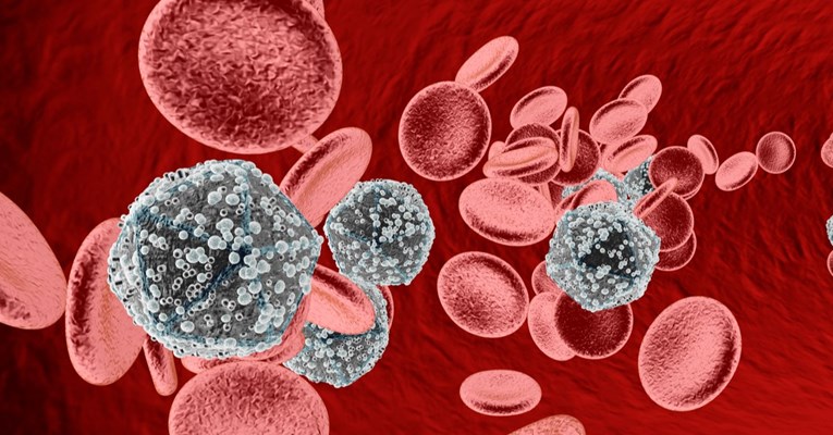 Nova visoko virulentna varijanta HIV-a otkrivena u Nizozemskoj