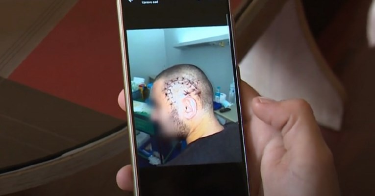 Uhićen mladić koji je Zadraninu nožem probio lubanju, pobjegao je u Slavoniju