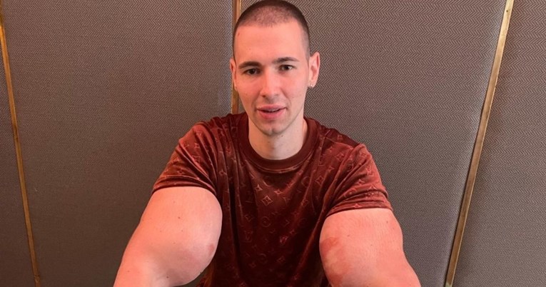Ruski Popaj mogao bi umrijeti ako ne ukloni otrovnu tvar iz bicepsa, tvrdi liječnik