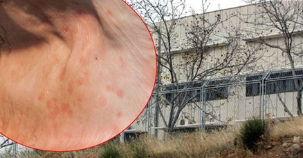 Ministarstvo pravosuđa: U zatvoru nema epidemije svraba, uređujemo sobu za susrete s djevojkama