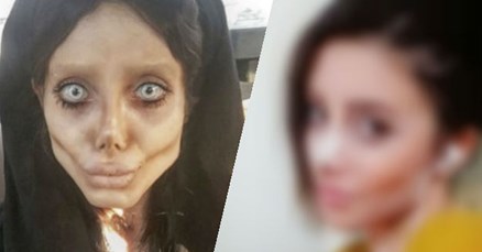 FOTO Evo kako je nekad izgledala cura koja se operirala 50 puta da sliči Angelini Jolie