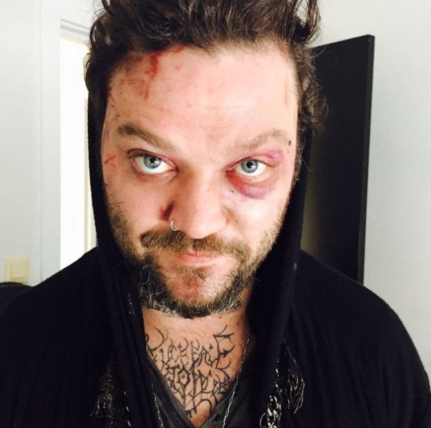 Jackassovac Bam Margera brutalno napadnut na islandskom festivalu