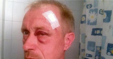 Podignuta optužnica protiv napadača na Peratovića: Ipak ih se ne tereti za pokušaj ubojstva