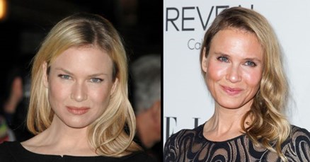 Što se dogodilo s licem Renee Zellweger?