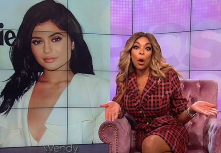 Voditeljica poručila Kylie da će joj dijete izgledati kao ona prije operacija