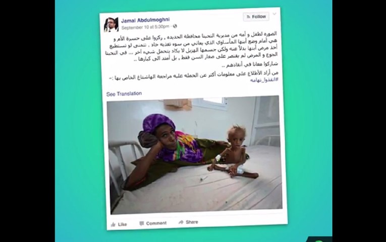 Strašna snimka: Milijuni djece u Jemenu umiru od gladi i bolesti jer Saudijci blokiraju pomoć