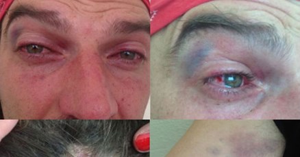 Odvjetništvo odmah pustilo dubrovačkog humanitarca na slobodu, policija podnosi kaznenu prijavu